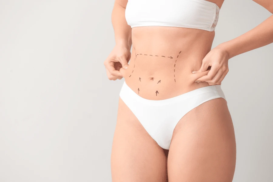 Karın Germe Ameliyatı (Abdominoplasti)