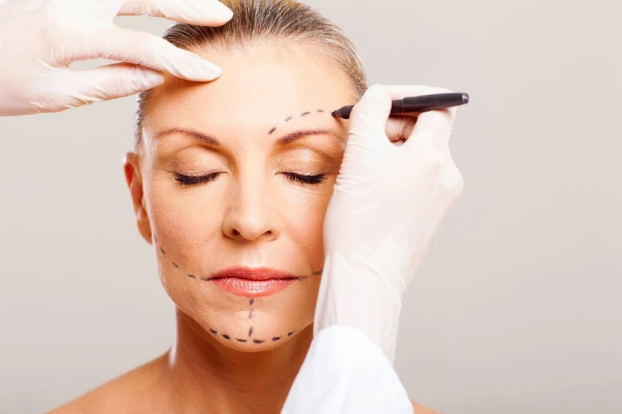 Facelift Turkey: Rhytidectomy Surgery