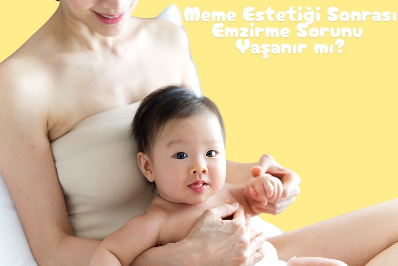 Meme Estetiği Sonrası Emzirme Sorunu Yaşanır mı?