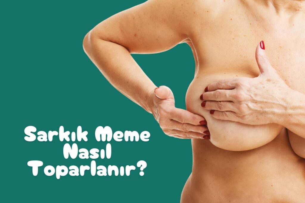 Sarkık Meme Nasıl Toparlanır