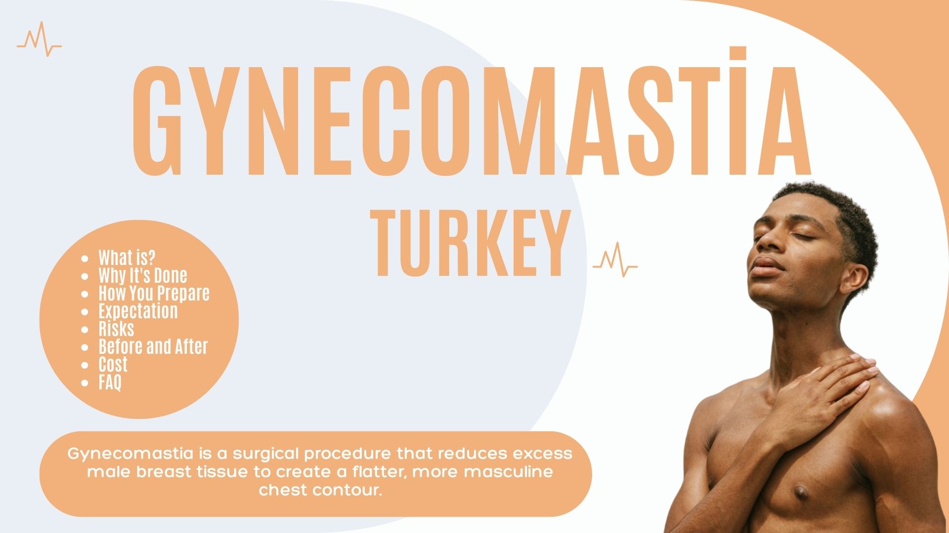 Gynecomastia