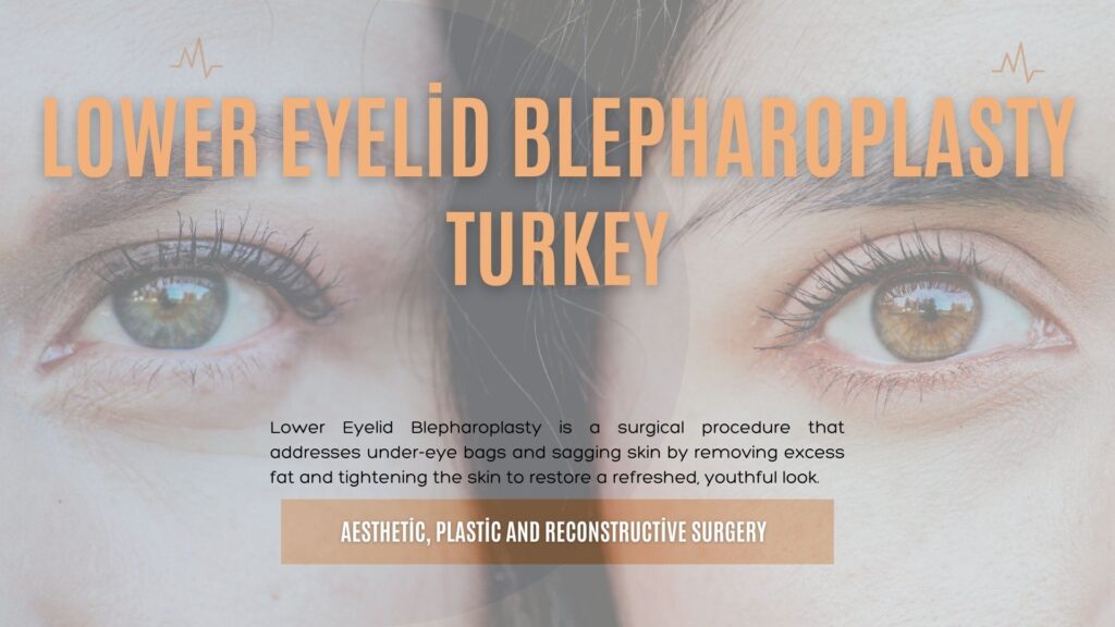 Lower Eyelid Blepharoplasty