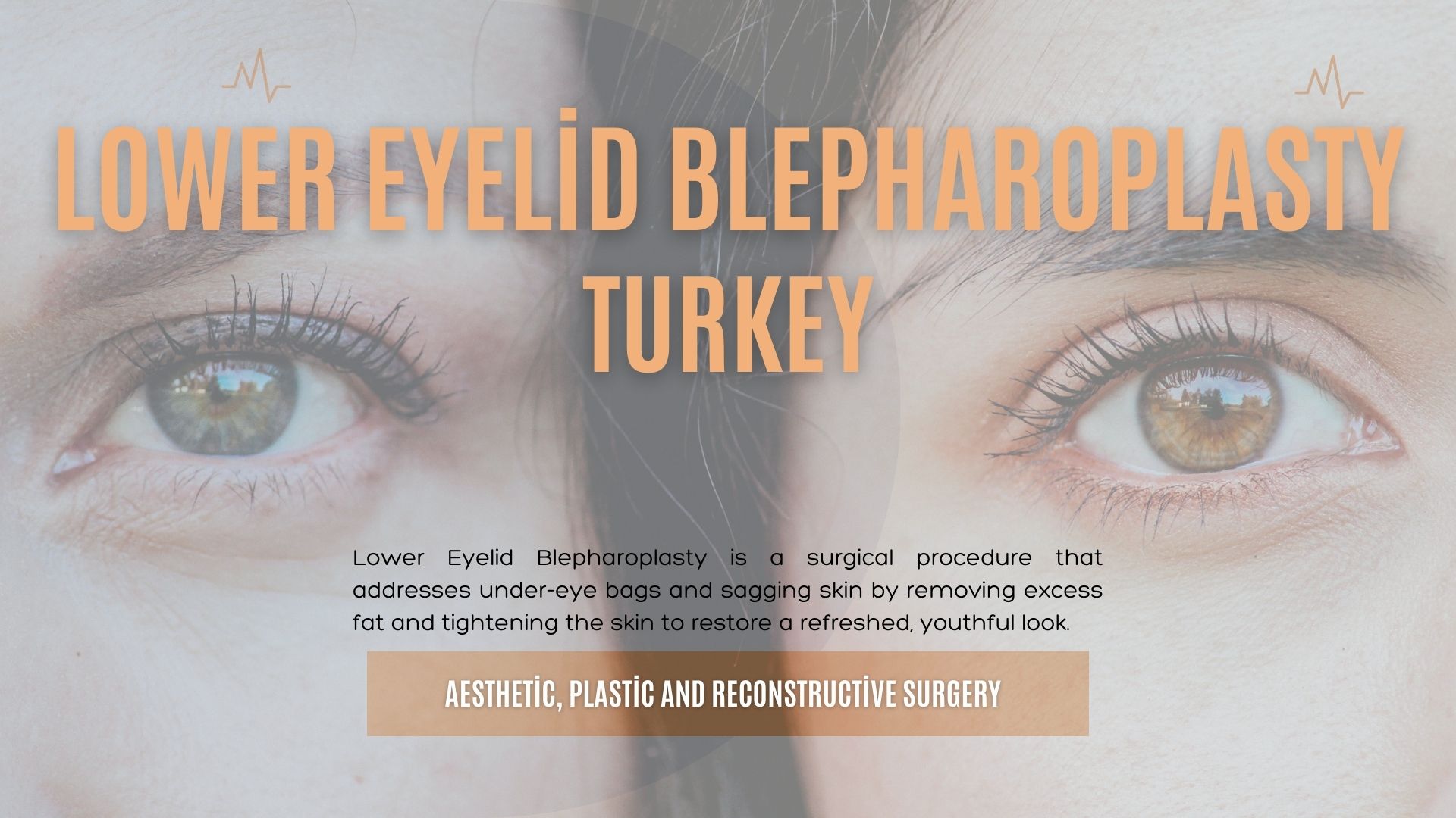 Lower Eyelid Blepharoplasty