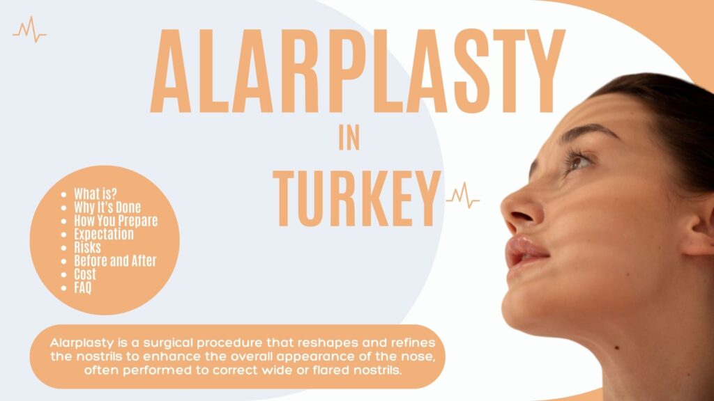 Alarplasty