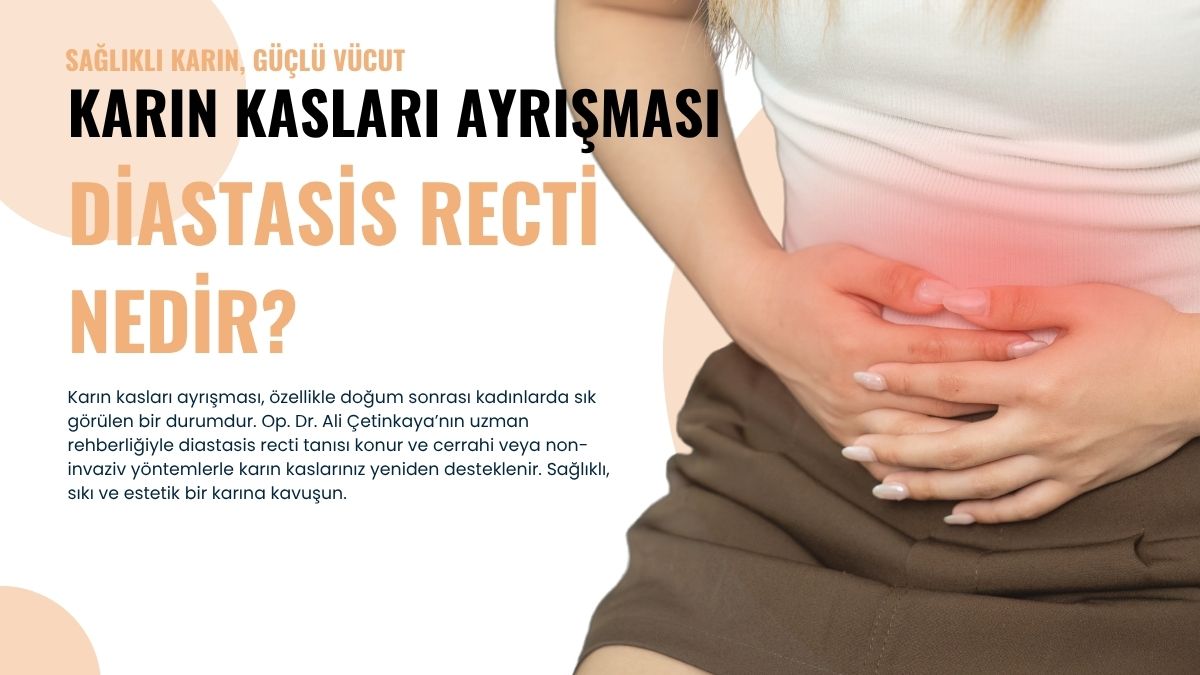 Karın Kasları Ayrışması (Diastasis Recti) Nedir?