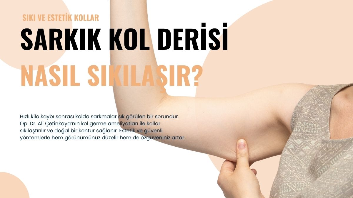 Kilo Verdikten Sonra Kolda Deri Sarkması Nasıl Geçer?