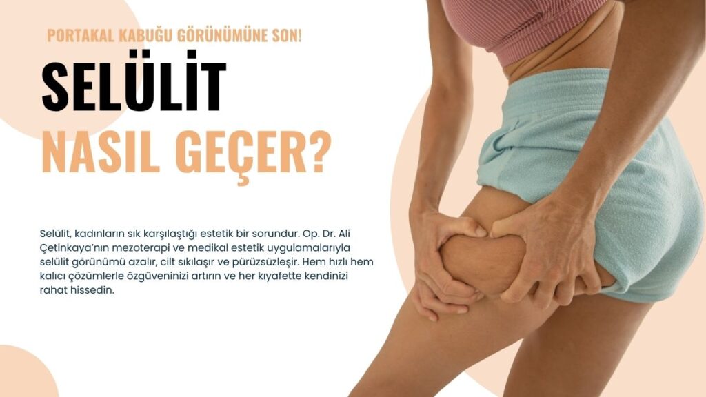 Selülit, kadınların sık karşılaştığı estetik bir sorundur. Op. Dr. Ali Çetinkaya’nın mezoterapi ve medikal estetik uygulamalarıyla selülit görünümü azalır, cilt sıkılaşır ve pürüzsüzleşir. Hem hızlı hem kalıcı çözümlerle özgüveninizi artırın ve her kıyafette kendinizi rahat hissedin.