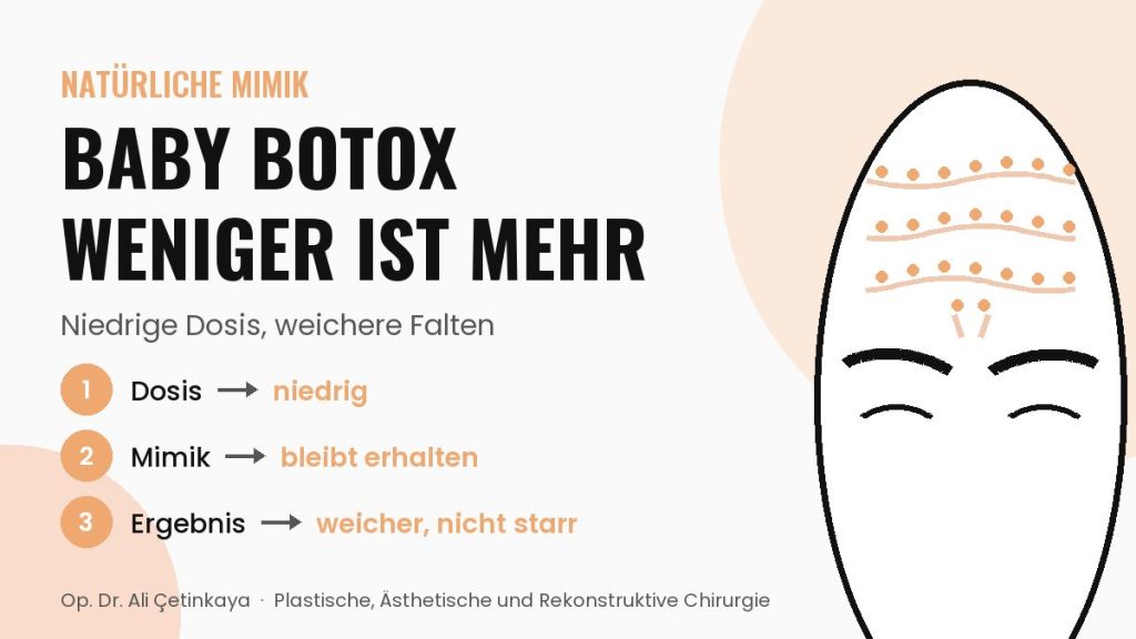 Schema einer Stirn mit feinen Falten und vielen kleinen Injektionspunkten (Baby Botox)