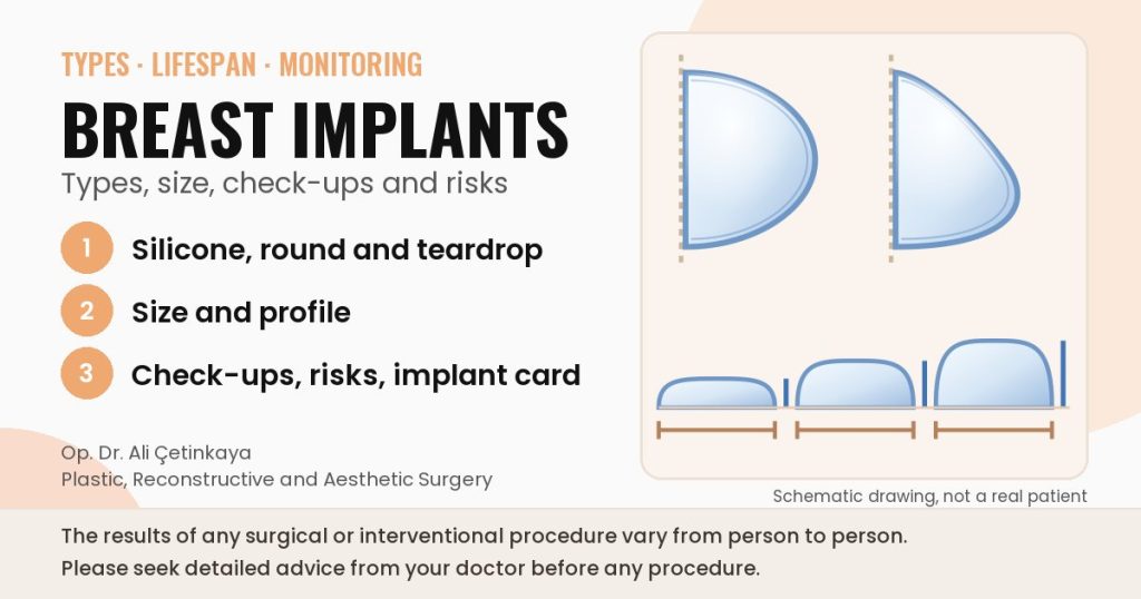 Schematic drawing of breast implant types: side views of round and teardrop implants and low, moderate and high profiles