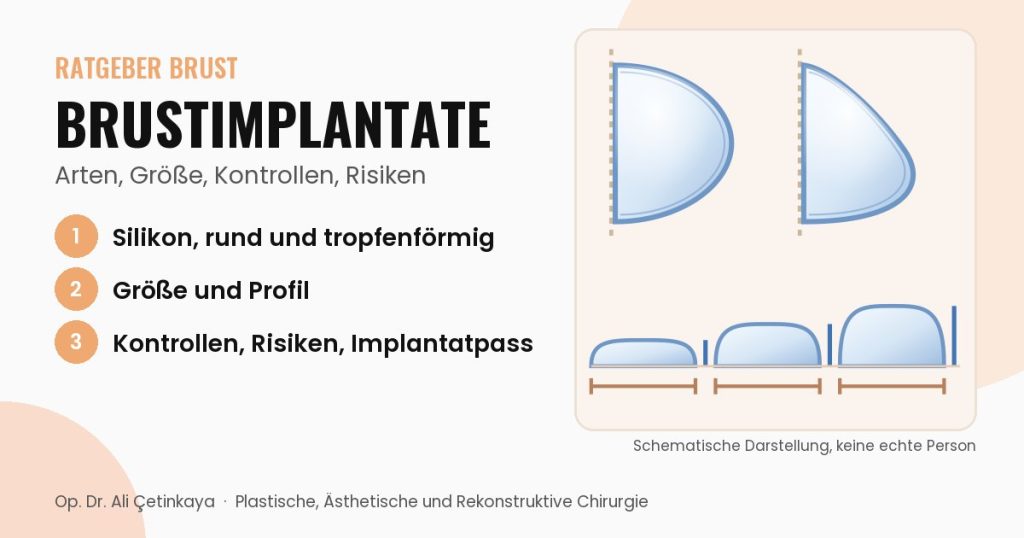 Schemazeichnung der Implantatarten: runde und tropfenförmige Implantate im seitlichen Schnitt sowie niedriges, mittleres und hohes Profil