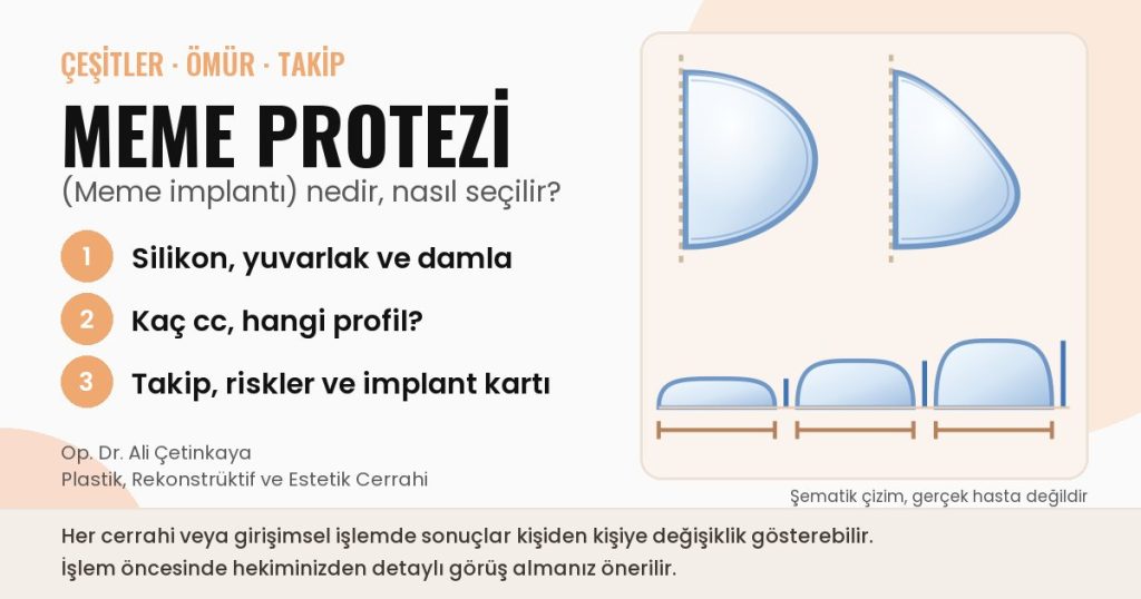 Meme protezi çeşitleri şematik çizim: yuvarlak ve anatomik protez kesiti, düşük, orta ve yüksek profil