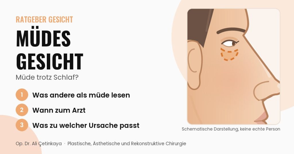 Seitliche Schemazeichnung des Gesichts mit hervorgehobener Schwellung und Mulde unter dem Auge
