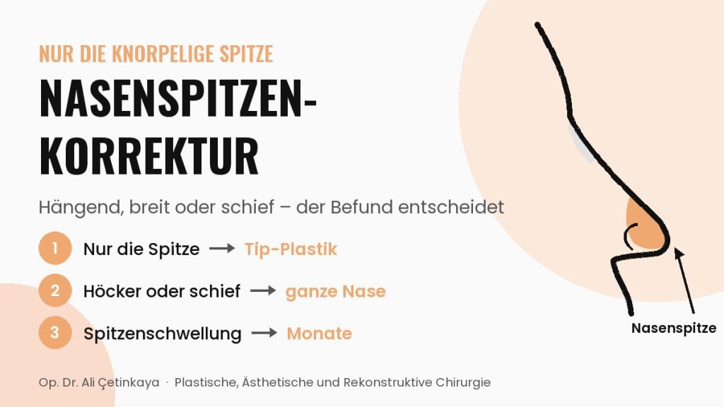Schematisches Nasenprofil, in dem der knorpelige Bereich der Nasenspitze hervorgehoben ist