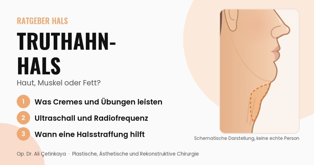 Seitliche Schemazeichnung von Kinn und Hals mit hervorgehobener erschlaffter Haut am vorderen Hals